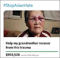 Assaulted asian woman